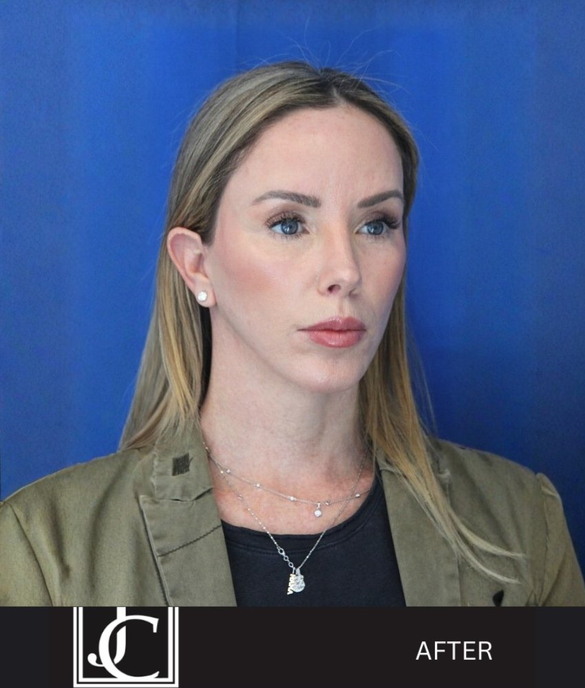 Dr. Jay Calvert on Precision, Trust, and the Evolution of Facial Aesthetic Surgery