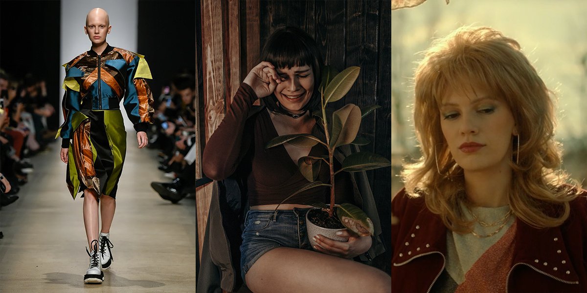 Liz Krutish: Living Without Hair, Dreaming Without Limits